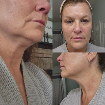 Eye & Neck Firming Duo